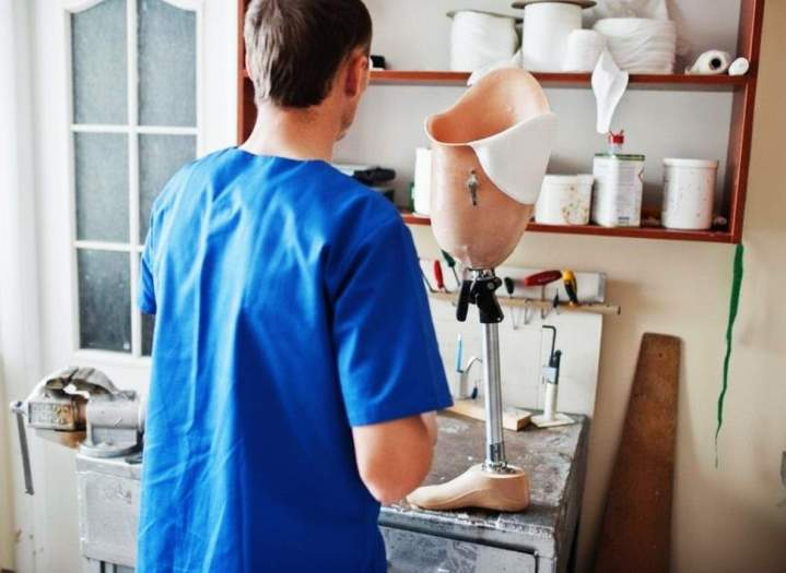 Fabrication prothèse Bras-Panon